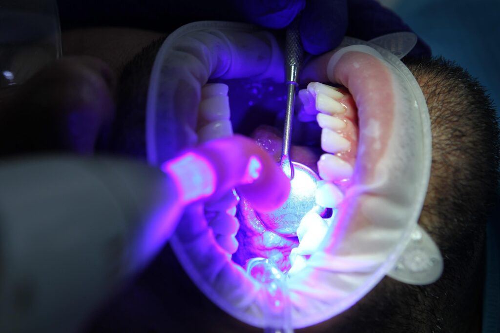 Whitening teeth