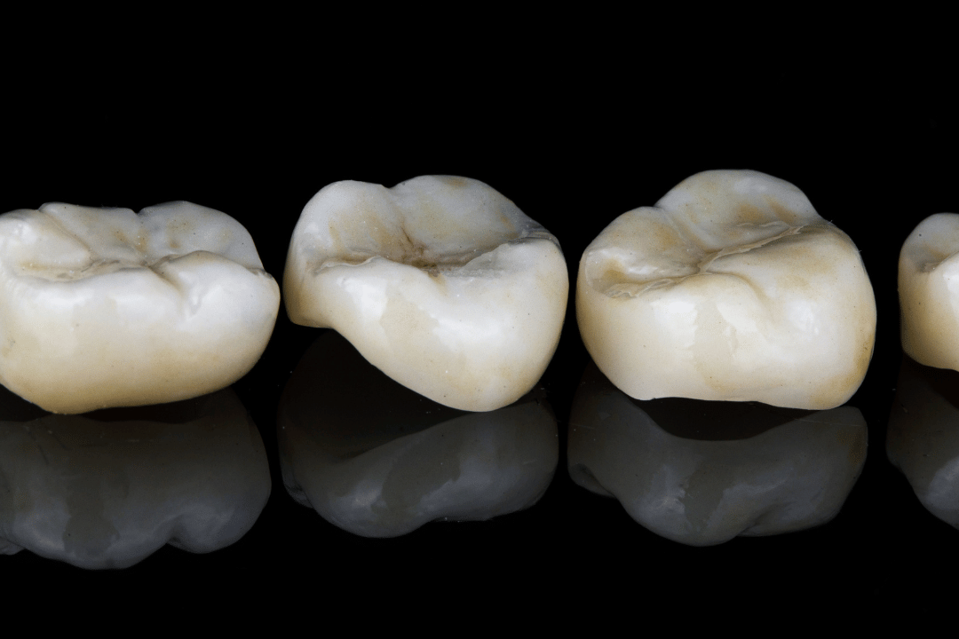 dental implant consultation Bethesda