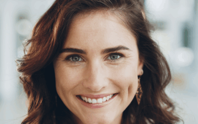 natural smile makeover results