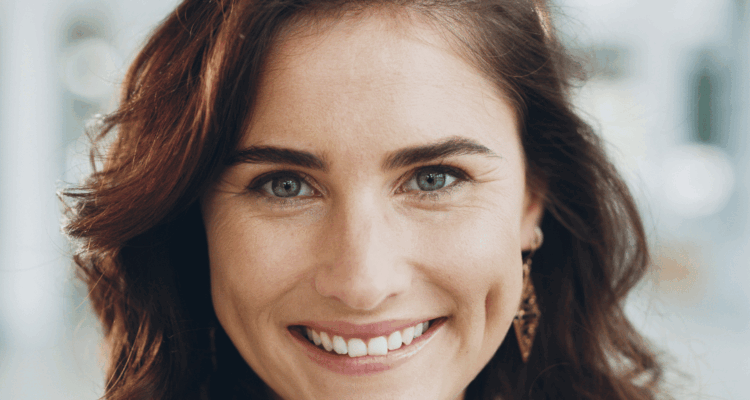 natural smile makeover results