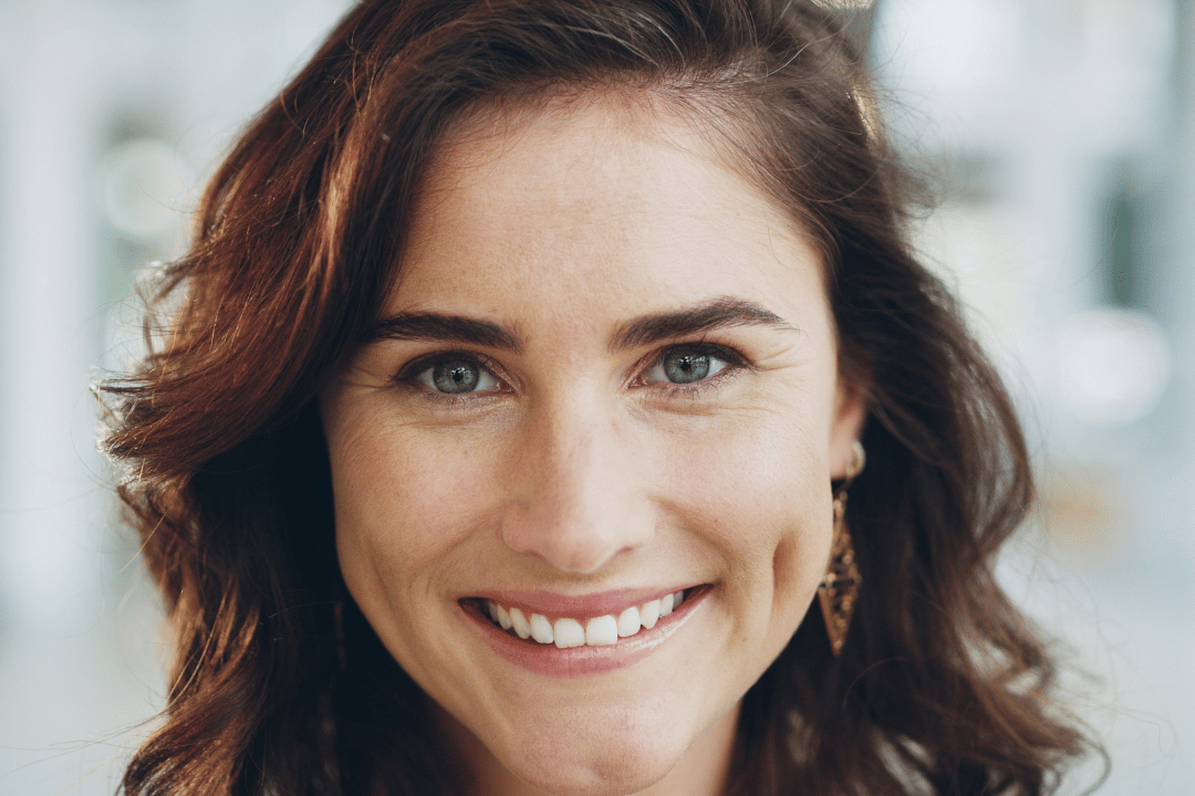 natural smile makeover results