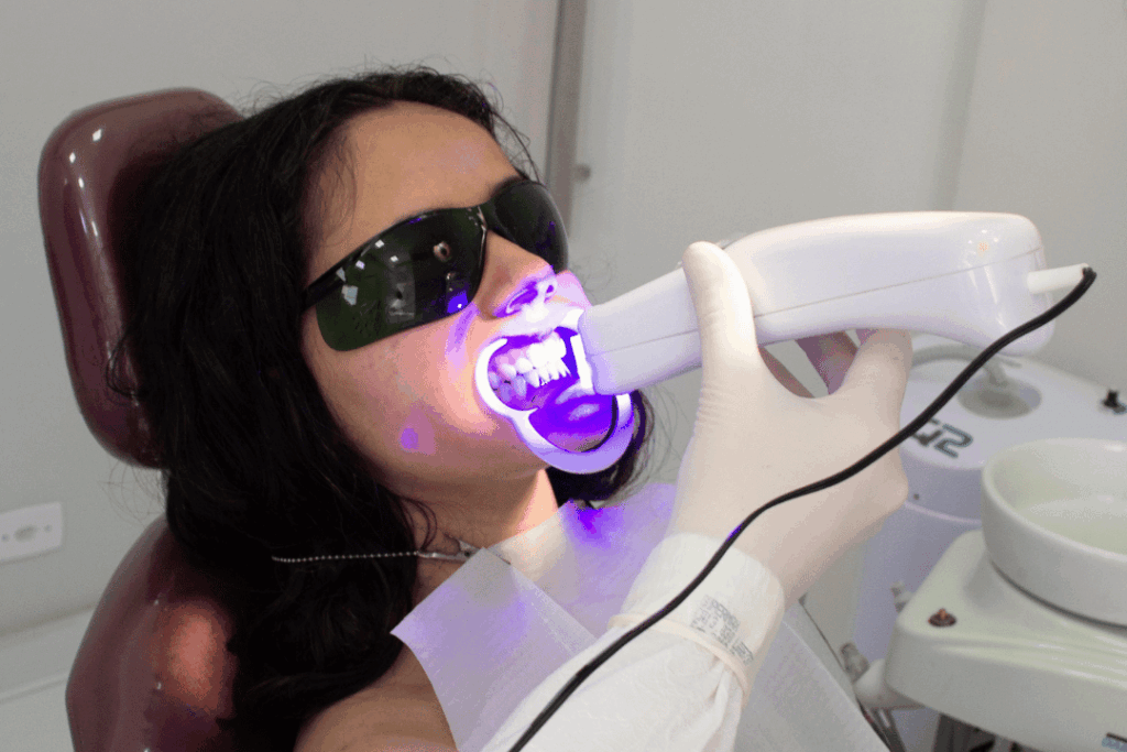 Bethesda dental office whitening treatment