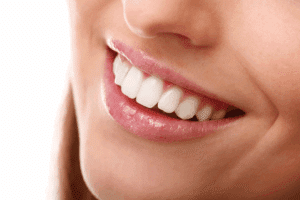 bright white smile after teeth whitening
