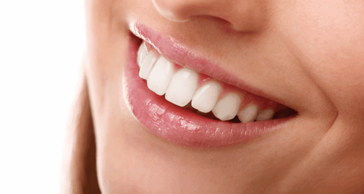 bright white smile after teeth whitening