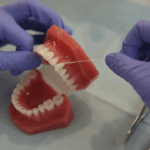 veneers consultation Bethesda