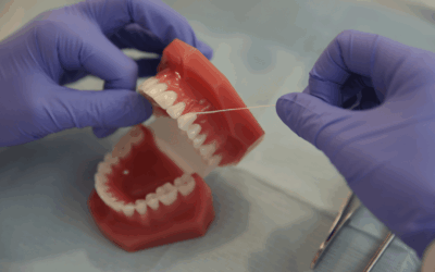 veneers consultation Bethesda