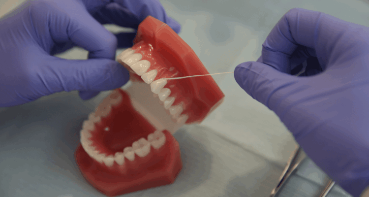 veneers consultation Bethesda