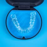 clear aligners for adults Bethesda