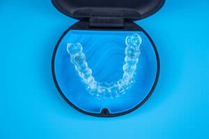 clear aligners for adults Bethesda