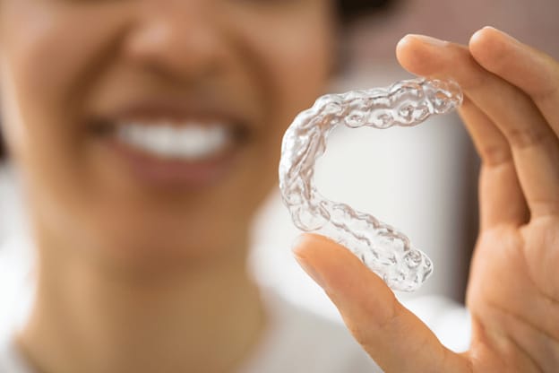 digital scan for invisible aligners